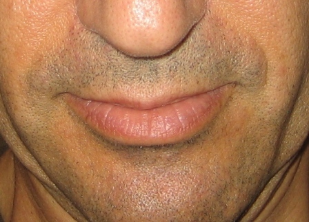 Linton Atlas